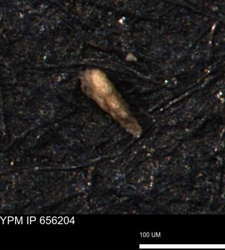 Verneuilina canadensis