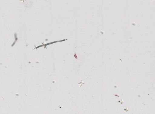 Ciliophora
