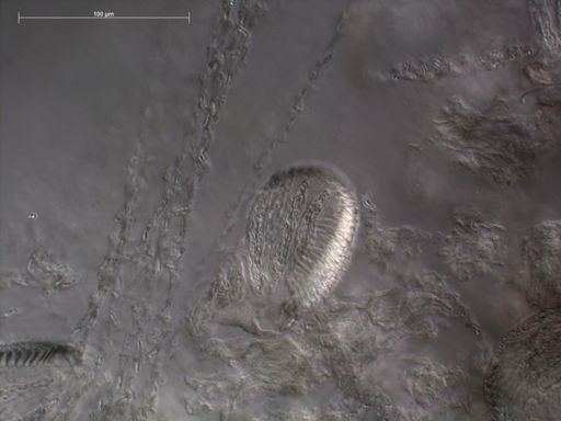 Hippopodius hippopus