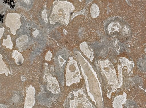 Taenia taeniaeformis