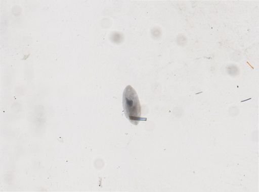 Paramecium