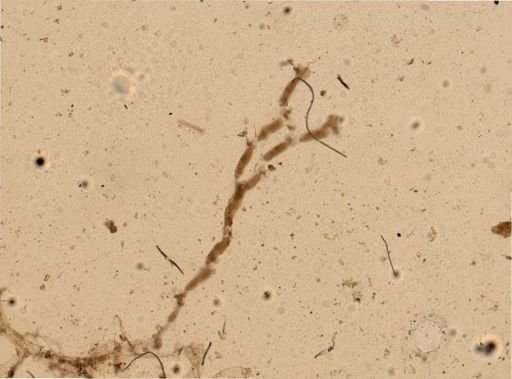 Kinetoskias uniserialis