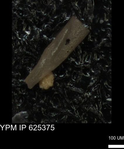 undet. Echinoidea