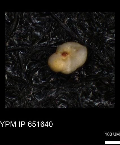 undet. Foraminiferida
