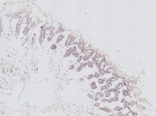 Stromatospongia norae