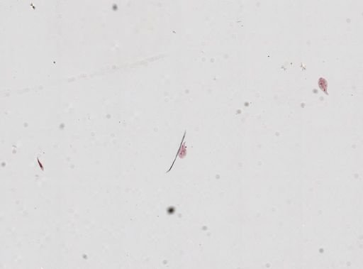 Ciliophora