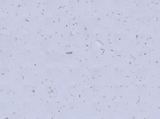 Tentorium semisuberites