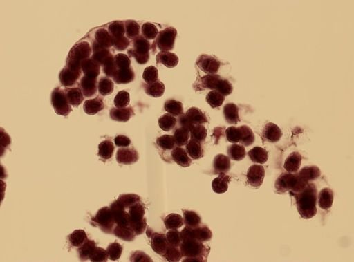 Echinococcus granulosus