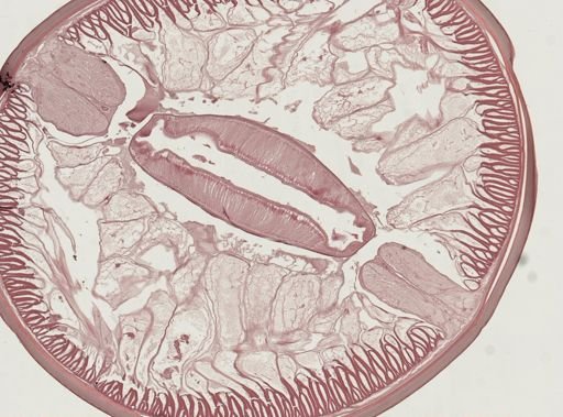 Ascaris lumbricoides