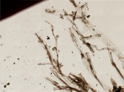Victorella pavida