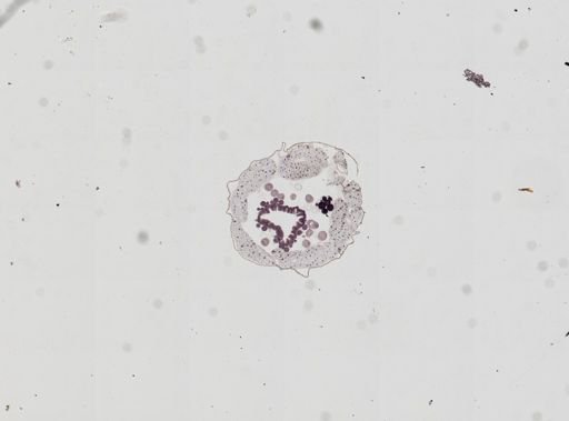 Plasmodium falciparum