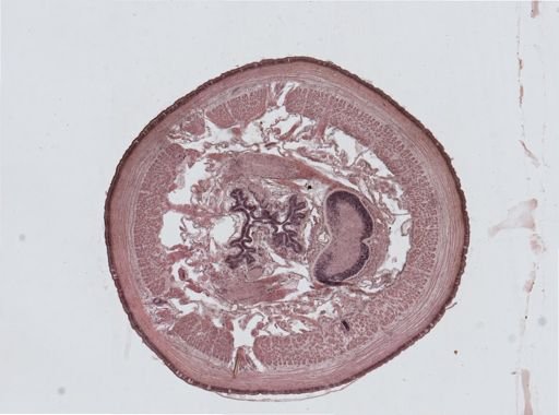Lumbricus terrestris