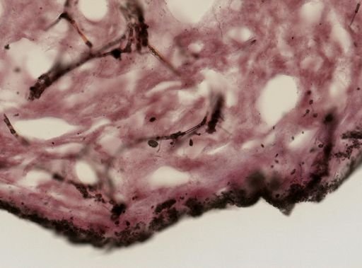 Ircinia