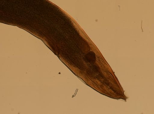 Enterobius vermicularis