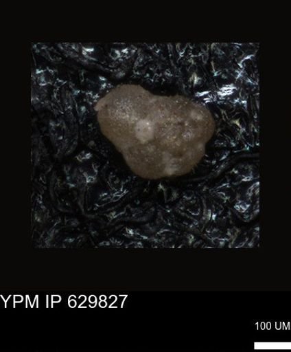 undet. Foraminiferida