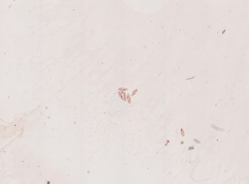 Paramecium