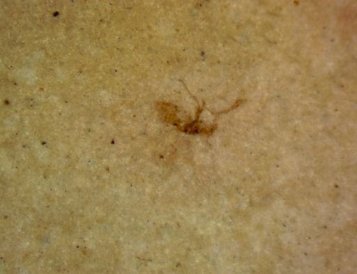 undet. Hexapoda