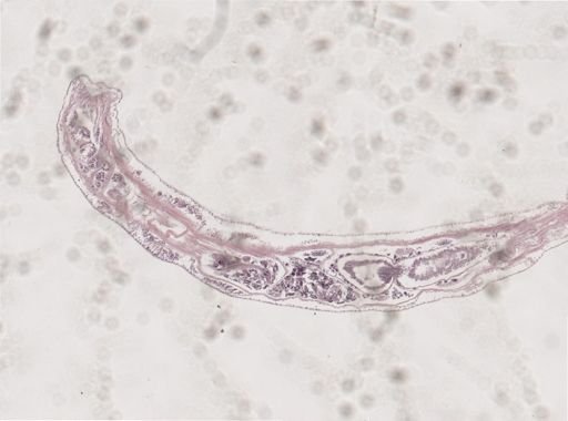Cambarincola vitreus