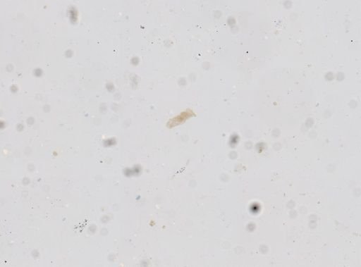 Strongyloides stercoralis