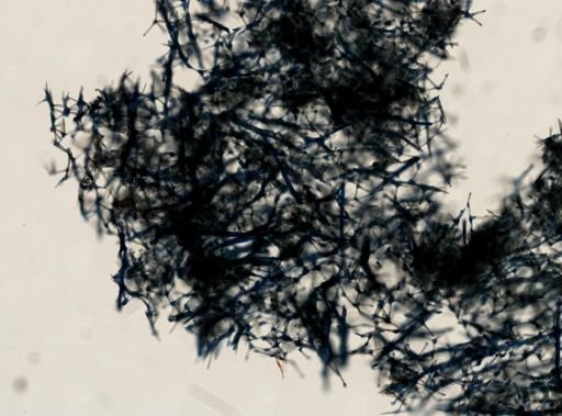 Haliclona oculata