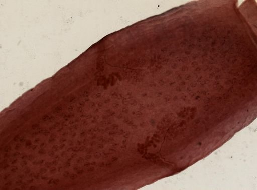 Dipylidium caninum