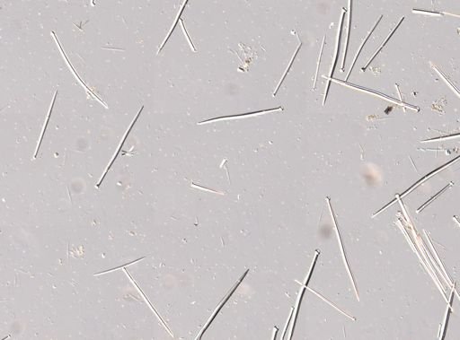 Suberites sp.
