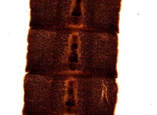 Diphyllobothrium erinacei