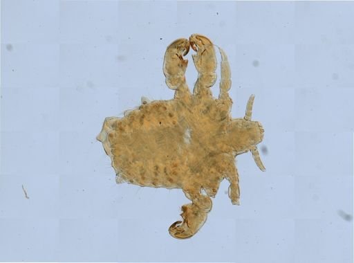Pthirus pubis