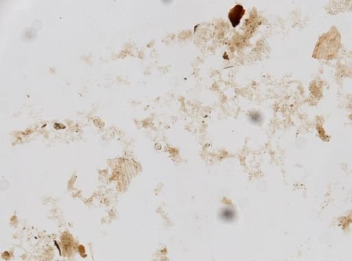 Trichuris trichiura