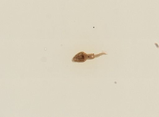 Echinostomatidae