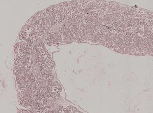 Modiolus