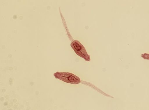 Echinostoma revolutum