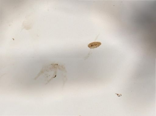 Paramecium