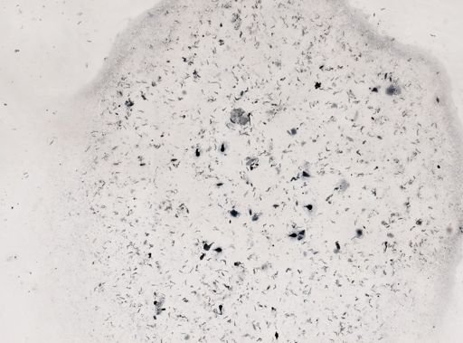 Protozoa