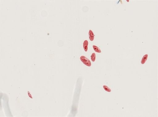 Paramecium calkinsi