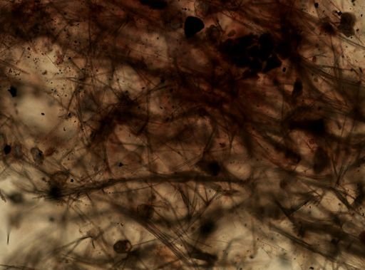 Axinellidae