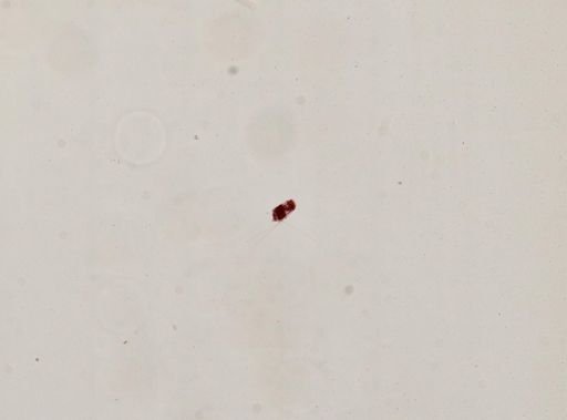 Filinia longiseta