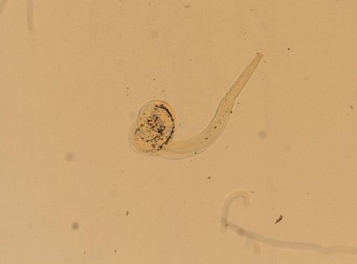 Enterobius vermicularis