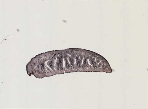 Foviella