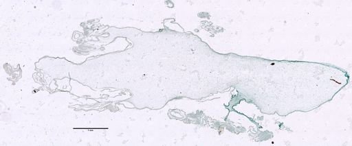 Nematostella?