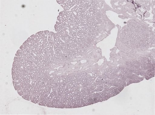 Oscarella lobularis