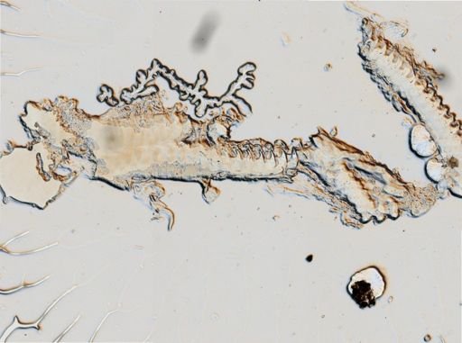 Onchidoris muricata