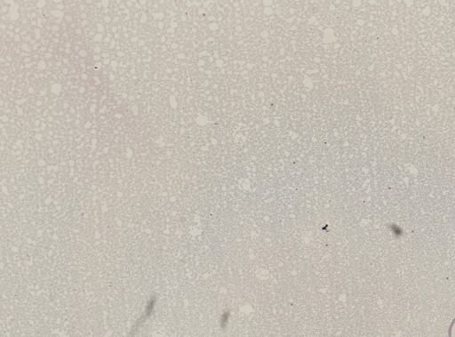 Plasmodium ovale