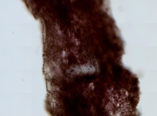 Haliclona