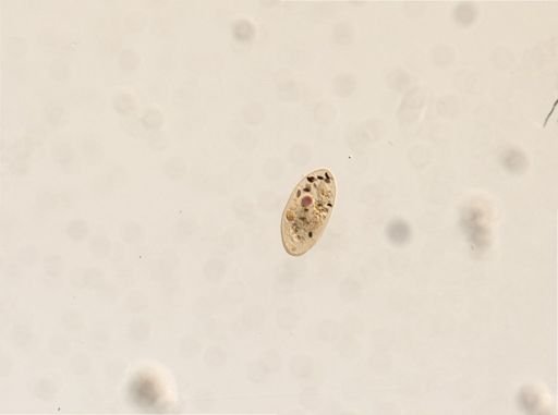 Frontonia