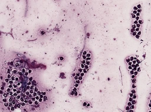 Onchocerca volvulus