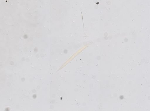 Necator americanus