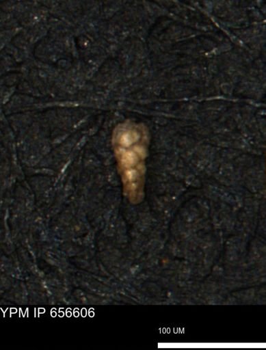 Verneuilina canadensis