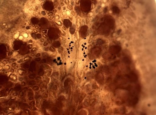 Pleioplana atomata
