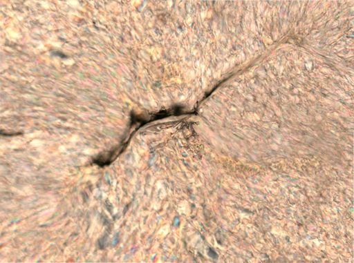 Trichocerca cylindrica